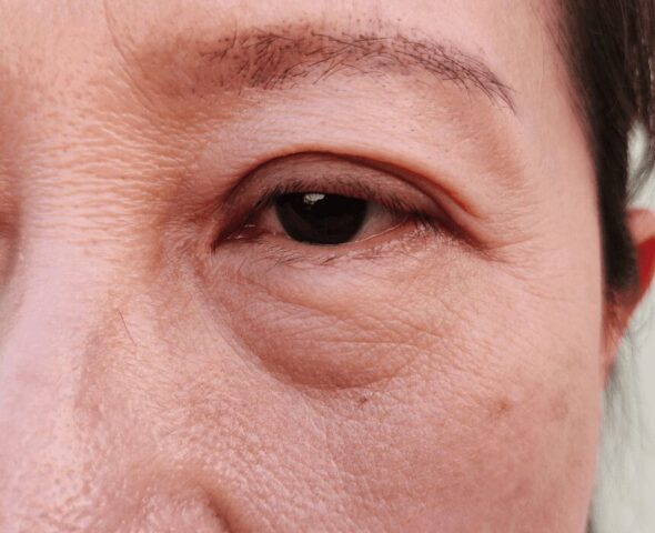 Cách Chăm Sóc Cây Si Cảnh: Hướng Dẫn Toàn Diện Từ Chuyên Gia