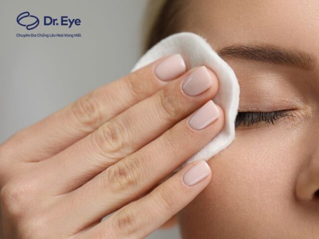 Cách Chăm Sóc Hoa Lan Treo Chi Tiết Đạt Chuẩn Chuyên Gia