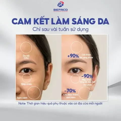 Hướng dẫn chi tiết trồng Mai Vàng trong chậu
