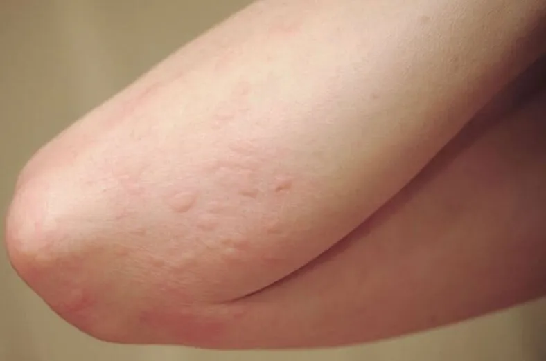 Sử dụng nhãn lòng quá nhiều trong ngày có thể gây ra các tác dụng phụ không mong muốn